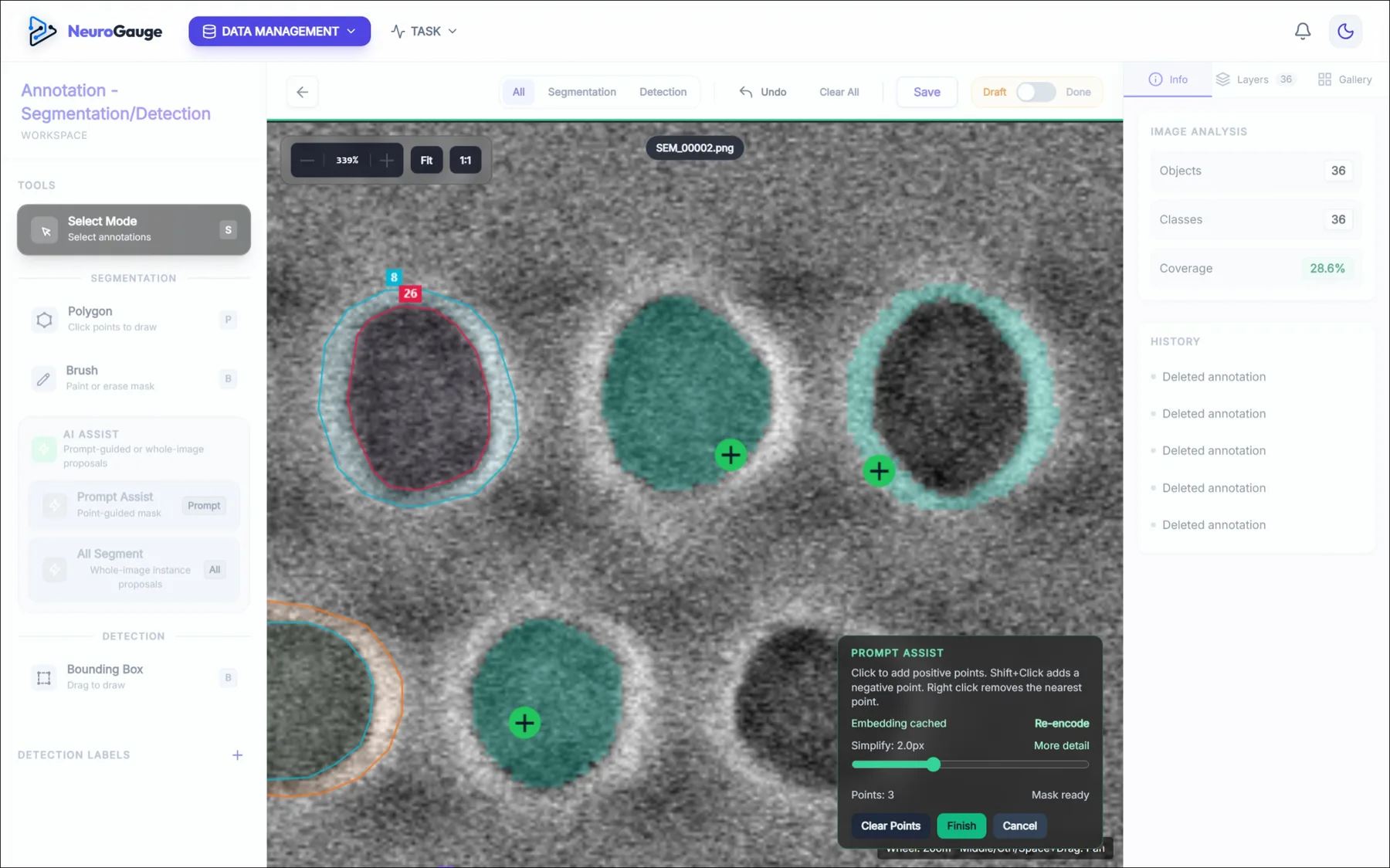 NeuroGauge AI Assist 어노테이션 화면